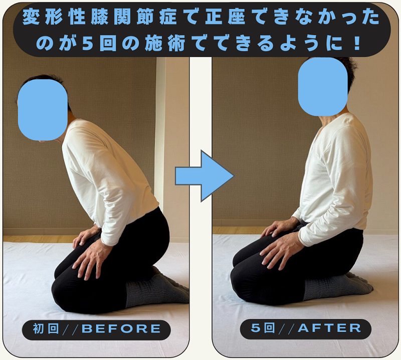 箕面市で膝痛でお悩みならしんそう箕面桜井に来られた変形性膝関節症の60代男性の正座写真（ビフォーアフター）